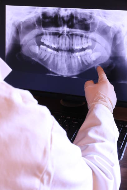 Best Emergency Treatment for Dental Infections or Abscesses in Green Meadows, OH