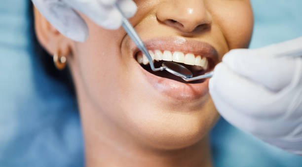 Best Emergency Tooth Extraction in Green Meadows, OH